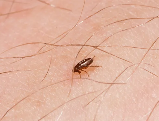 Dedetização de Pulga na Chácara Santo Antônio